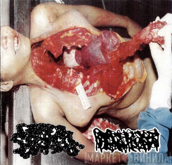 / Gored Stomach Contents  Hydrocephalus  - Gored Stomach Contents / Hydrocephalus Split