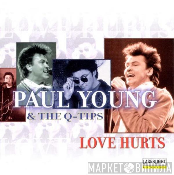 & Paul Young  The Q Tips  - Love Hurts