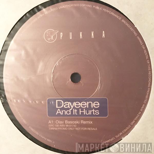 DaYeene - And It Hurts