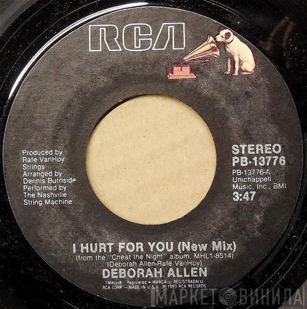 Deborah Allen - I Hurt For You