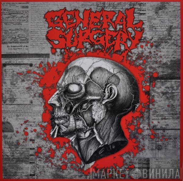 General Surgery, Butcher ABC - General Surgery / Butcher ABC