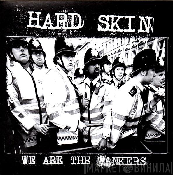  Hard Skin   - We Are The Wankers