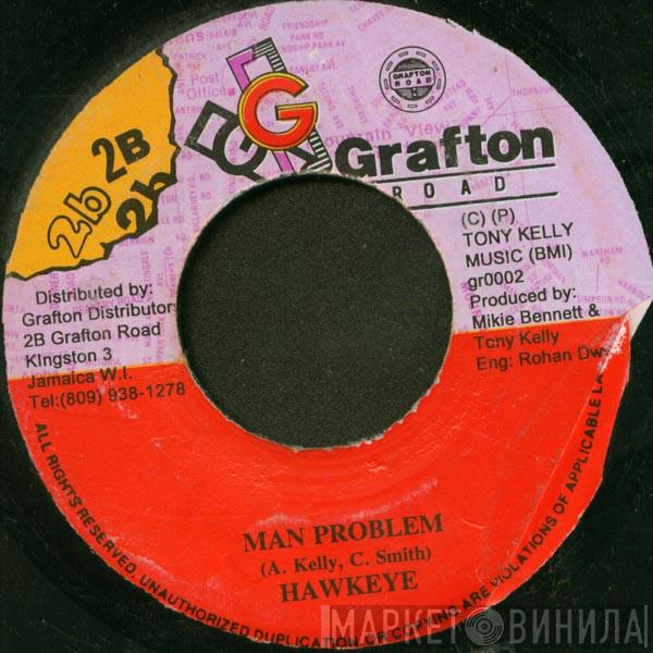 Hawkeye , Rohan Krew - Man Problem / Grafton Brew