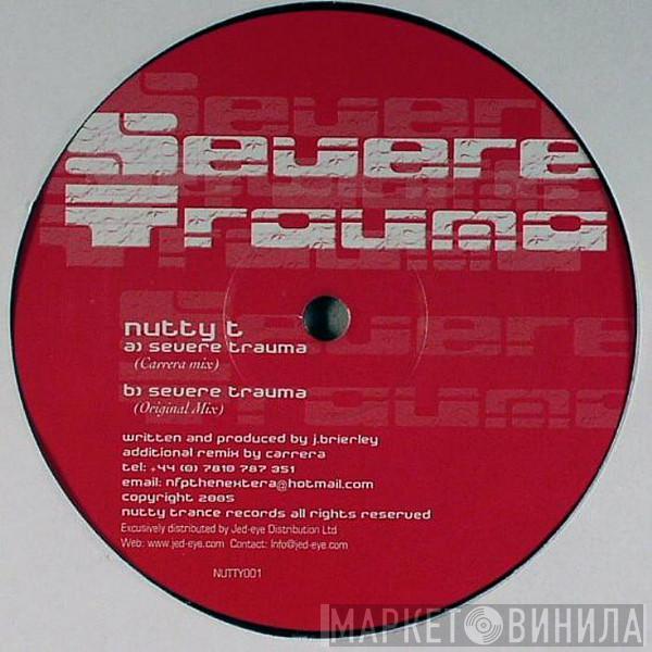 Nutty T - Severe Trauma