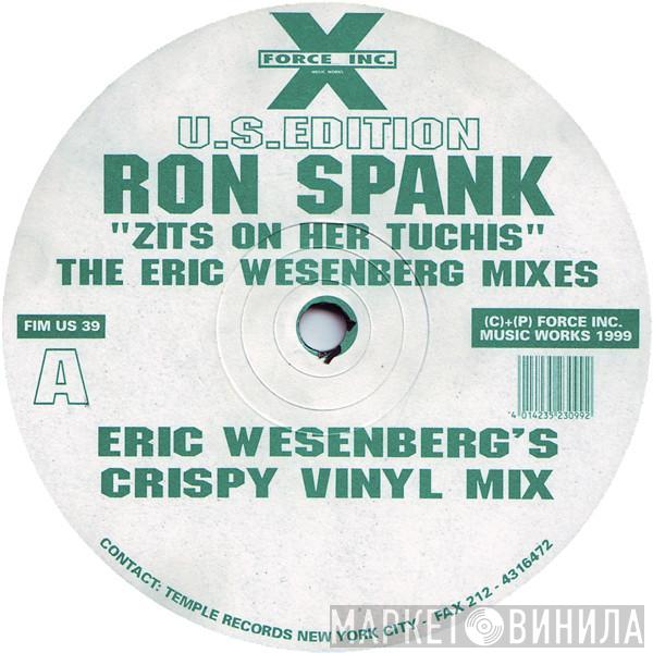 Ron Spank - Zits On Her Tuchis (The Eric Wesenberg Mixes)