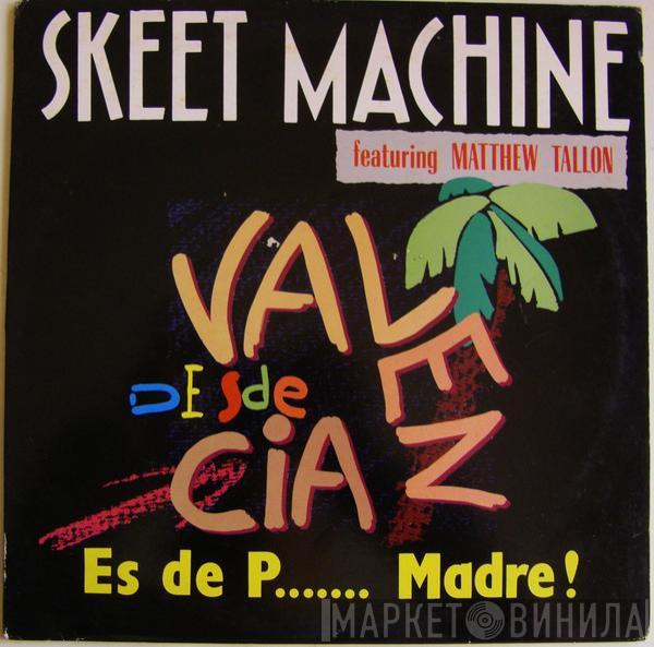 Skeet Machine, Matthew Tallon - Es De P... Madre!