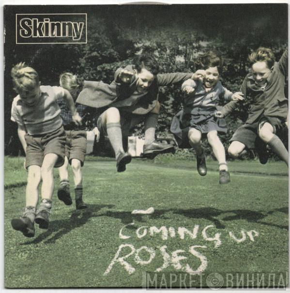 Skinny - Coming Up Roses