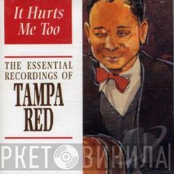 Tampa Red - It Hurts Me Too