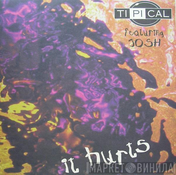 Ti.Pi.Cal. - It Hurts