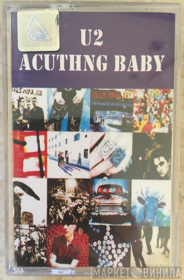  U2  - Acuthng Baby