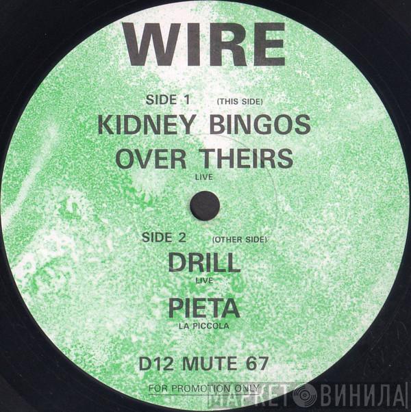 Wire - Kidney Bingos