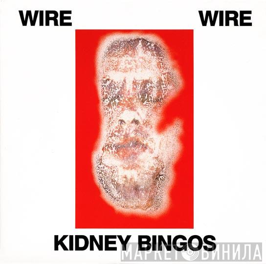  Wire  - Kidney Bingos