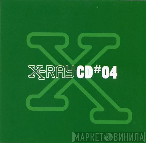  - X-Ray CD#04