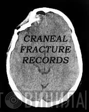 Craneal Fracture Records - Винил CD и Кассеты лейбла Craneal Fracture Records на сайте МаркетВинила